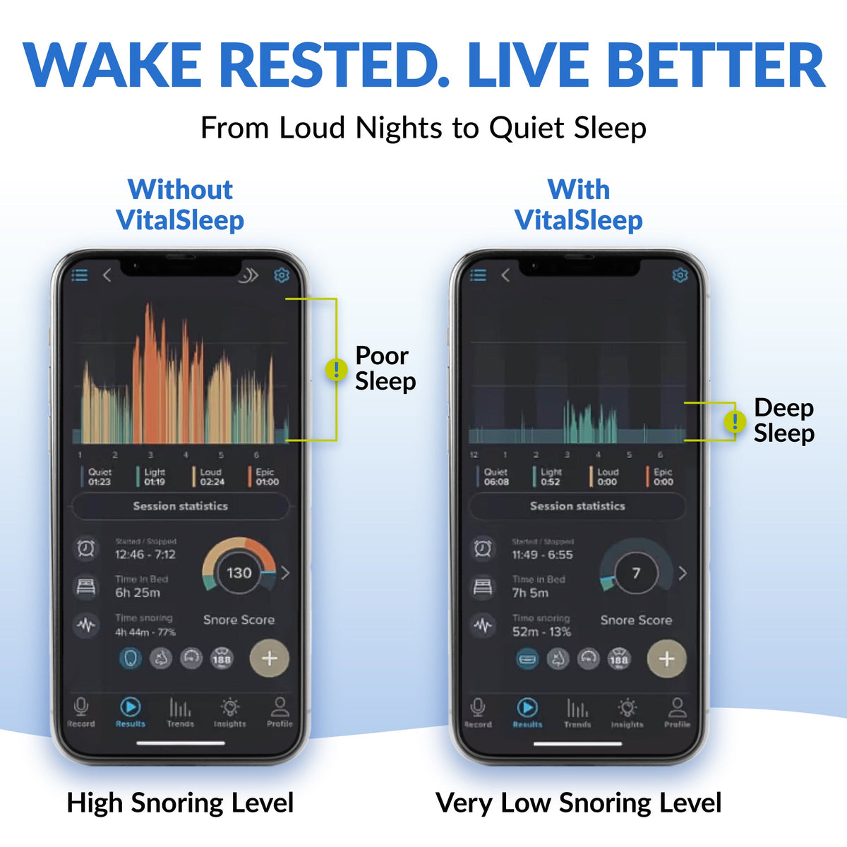 VisalSleep Adjustable Anti-Snoring Mouthpiece